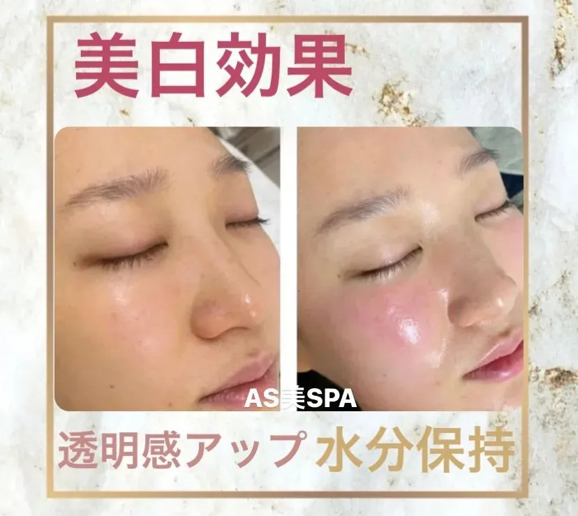 AS美SPAは有名人も御用達のサロンです✨✨✨✨