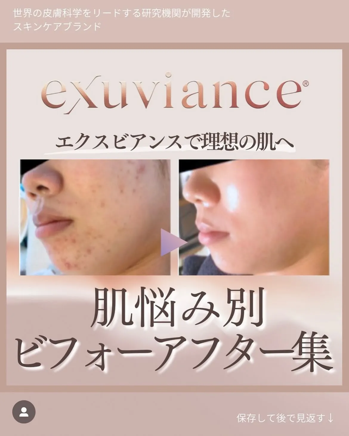 クリニカルコスメ”exuviance “